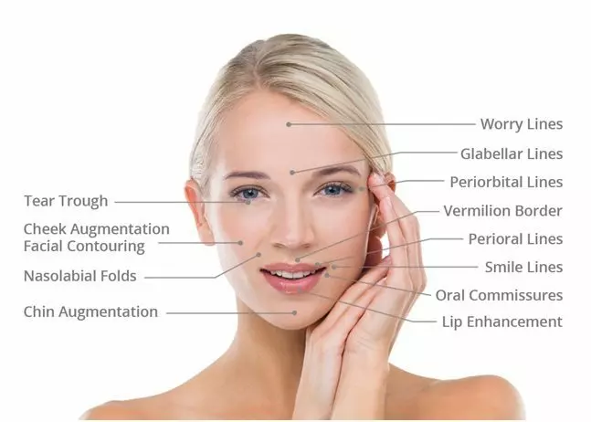 DERMAL FILLER FACELIFT TREATMENTS