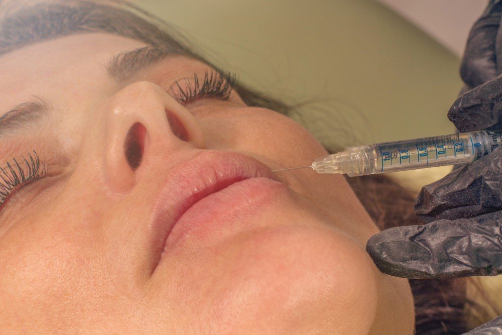 Smokers Lines Botox Treatment