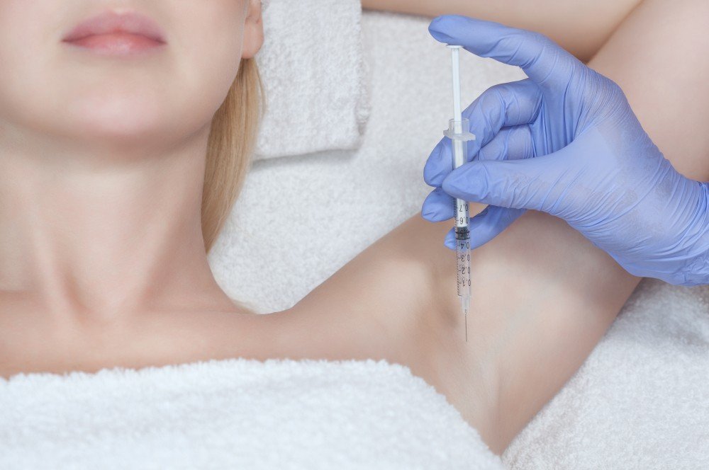 Excessive Forehead & Underarms Sweating treatment with botox