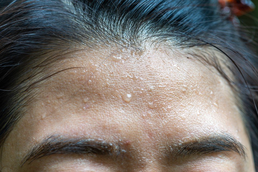 Excessive Forehead & Underarms Sweating treatment with botox